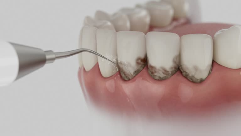 Reliable Dental contractor in St. John, IN by Dentist Open Now